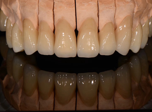 Fixed